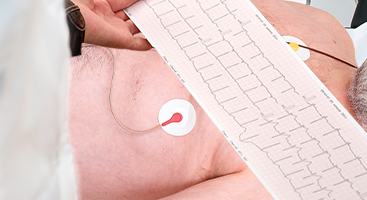 Resultados al momento durante un electrocardiograma