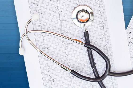 Hoja de resultados de un electrocardiograma